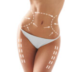 Body Contouring Training